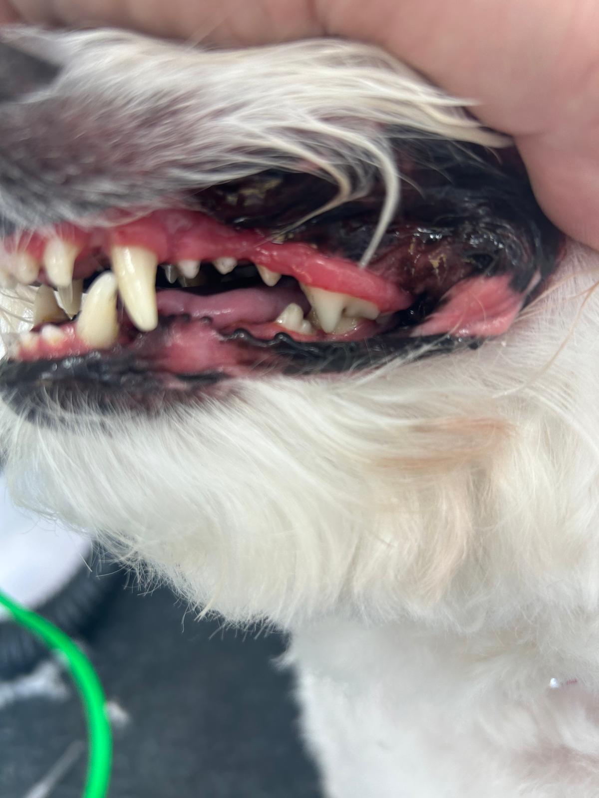 Deep dental cleaning